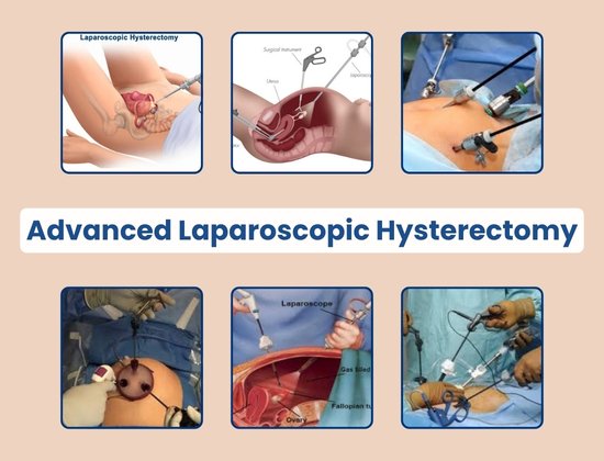Gallbladder Surgery